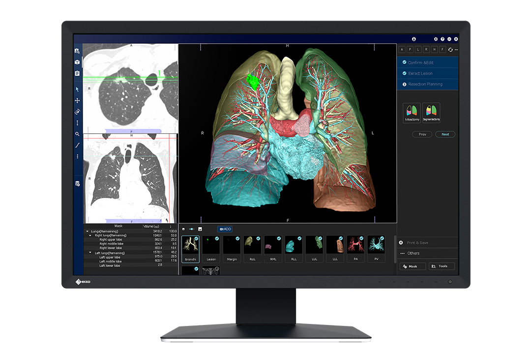 EIZO RadiForce MX243W