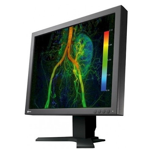CuratOR EX190 – diagnostický monitor