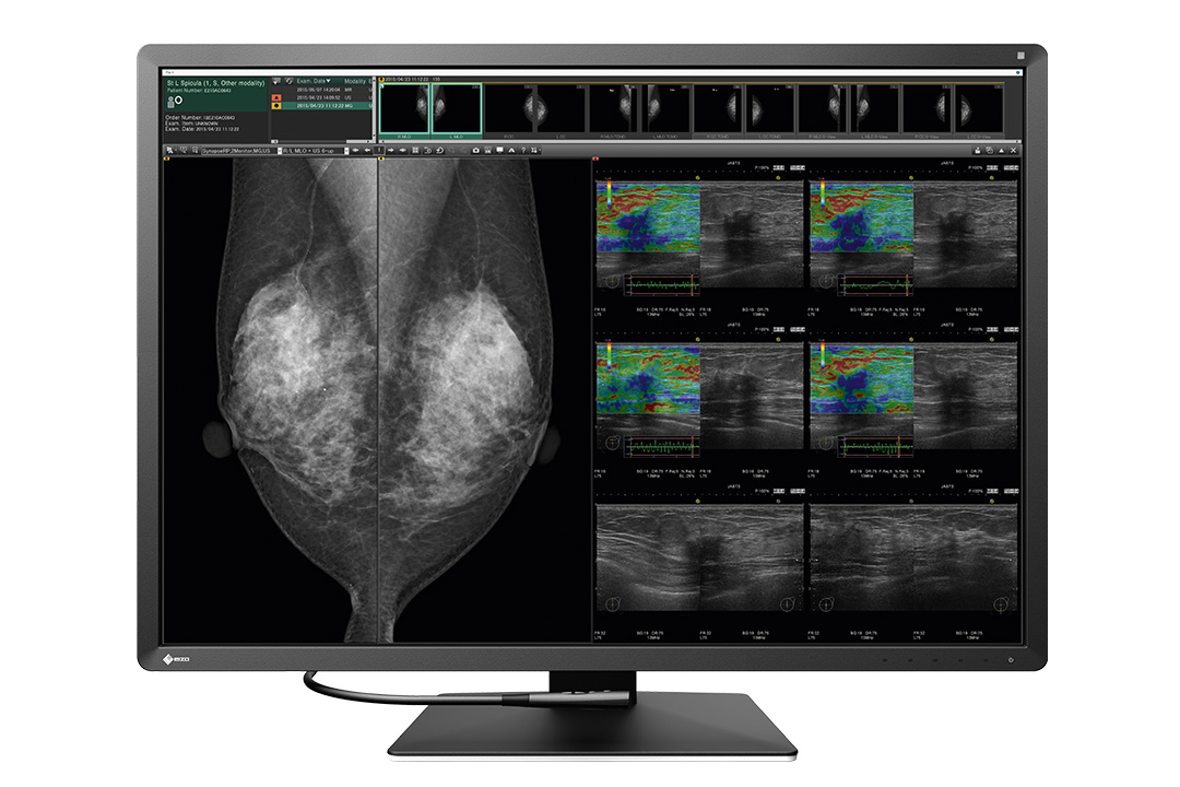 EIZO RadiForce RX1270